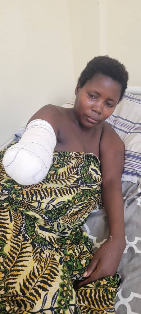 Photo of Claudine after surgery